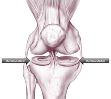 menisco medial e lateral